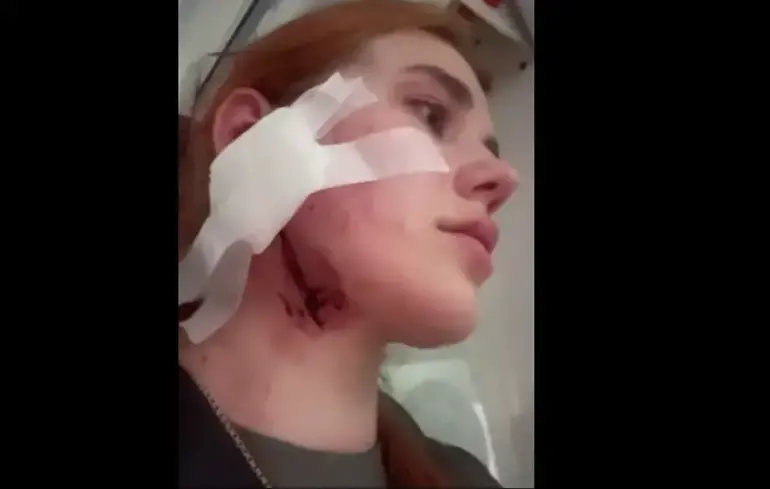 Напад через акцент у Вроцлаві: поляки проявили ксенофобію, Генконсульство України реагує