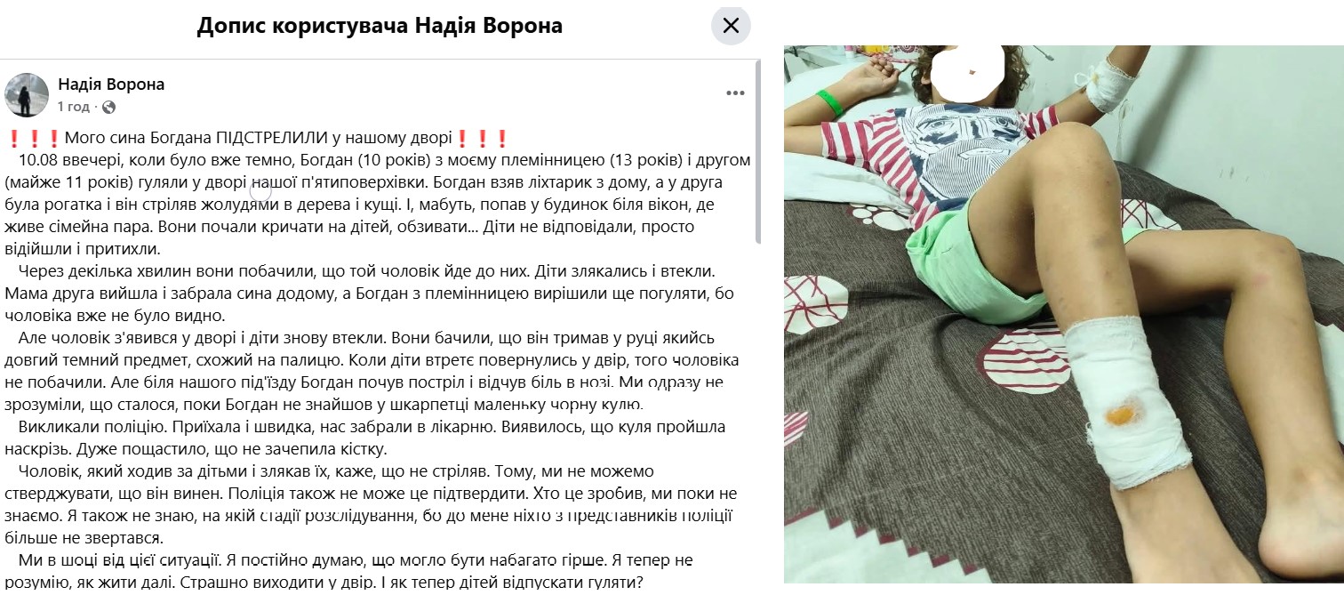 Черкаси: Куля прошила ногу дитини наскрізь.